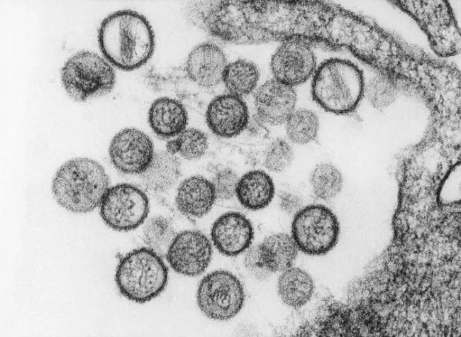 virus Hantavirus
