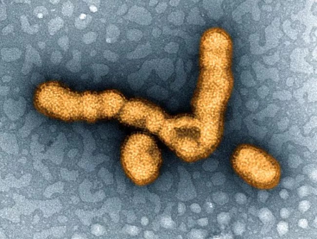 virus Influenza