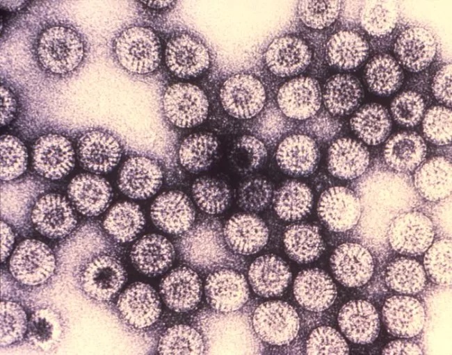virus Rotavirus